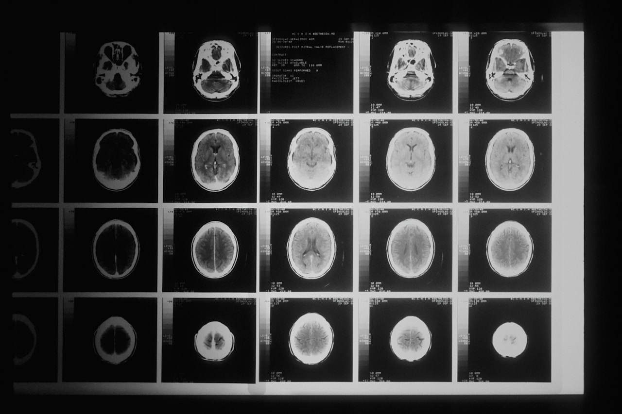 Atendimento em neurologia